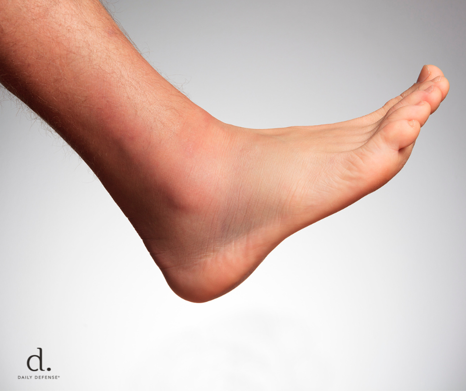 How Long Do Water Tablets Take to Reduce Swelling?